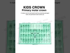 เจาะลึก: KIDS CROWN ครอบฟันกรามหลัก